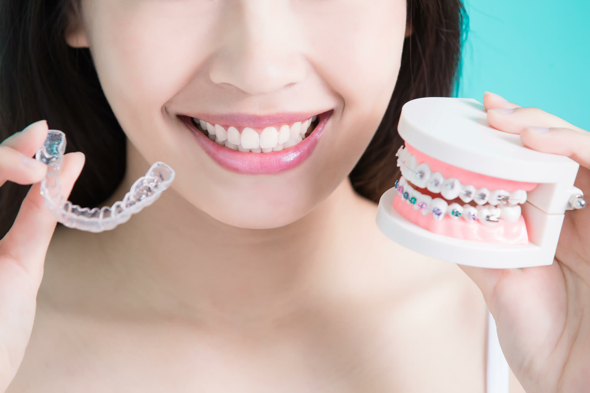 niềng răng Invisalign trong suốt