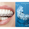 Chỉnh nha niềng răng trong suốt invisalign có hiệu quả không?