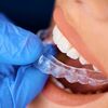 Cơ chế hoạt động của khay niềng răng Invisalign trong suốt