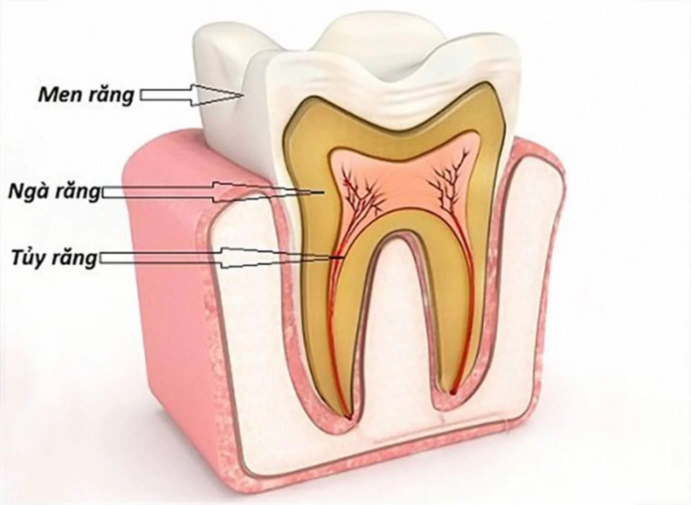 Bọc sứ sau khi lấy tủy tại Nha Khoa Bảo Nha